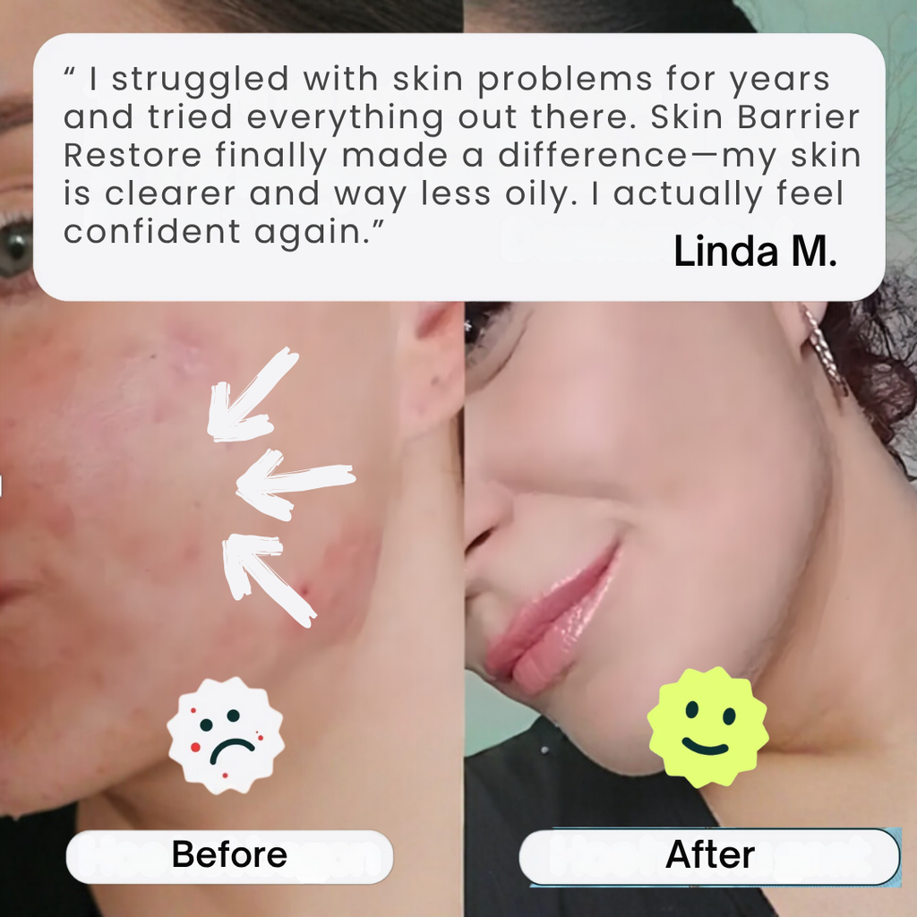 Skin Barrier Restore* Phytoceramides Complex