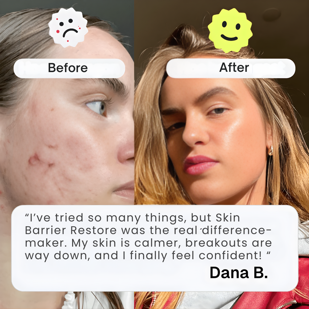 Skin Barrier Restore* Phytoceramides Complex