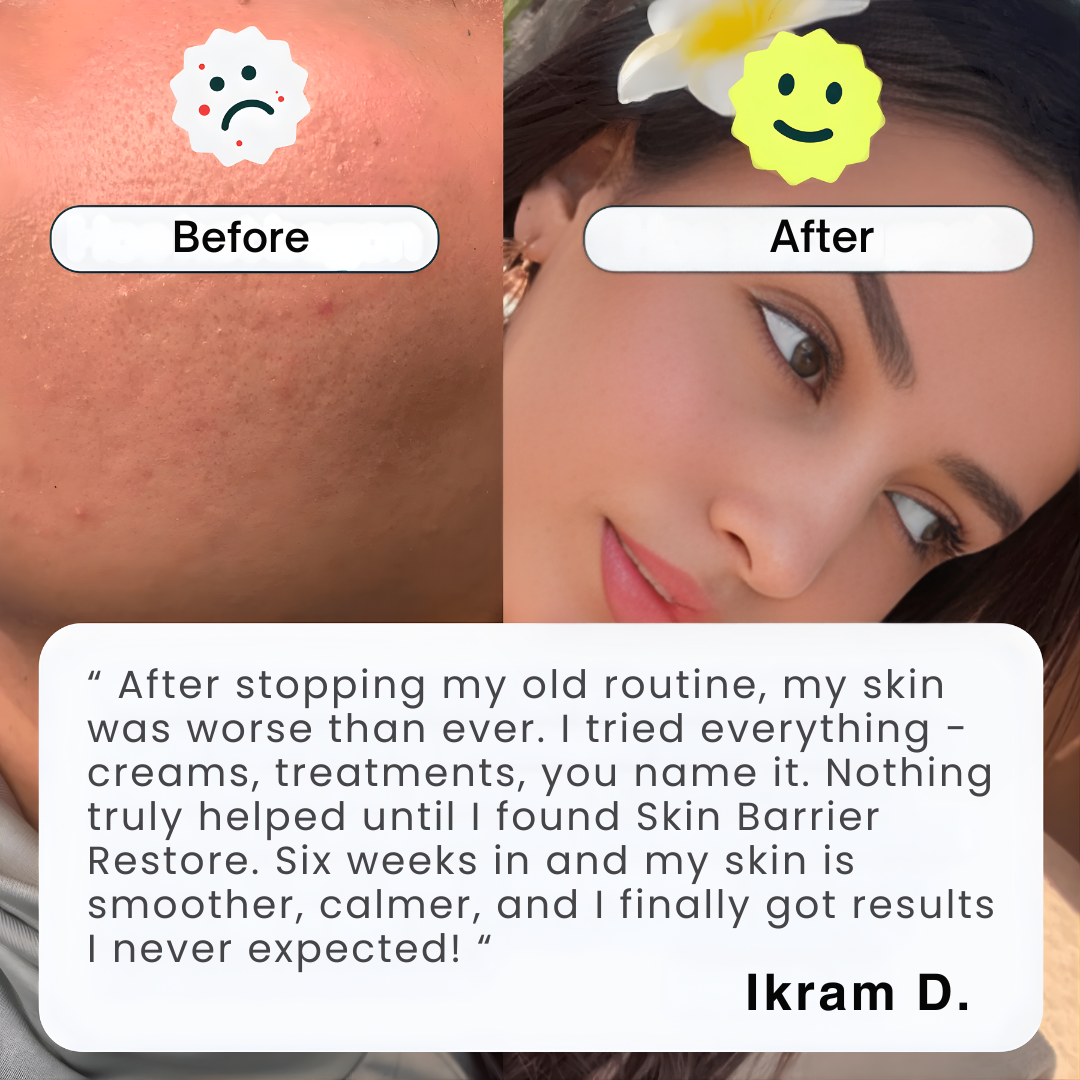 Skin Barrier Restore* Phytoceramides Complex